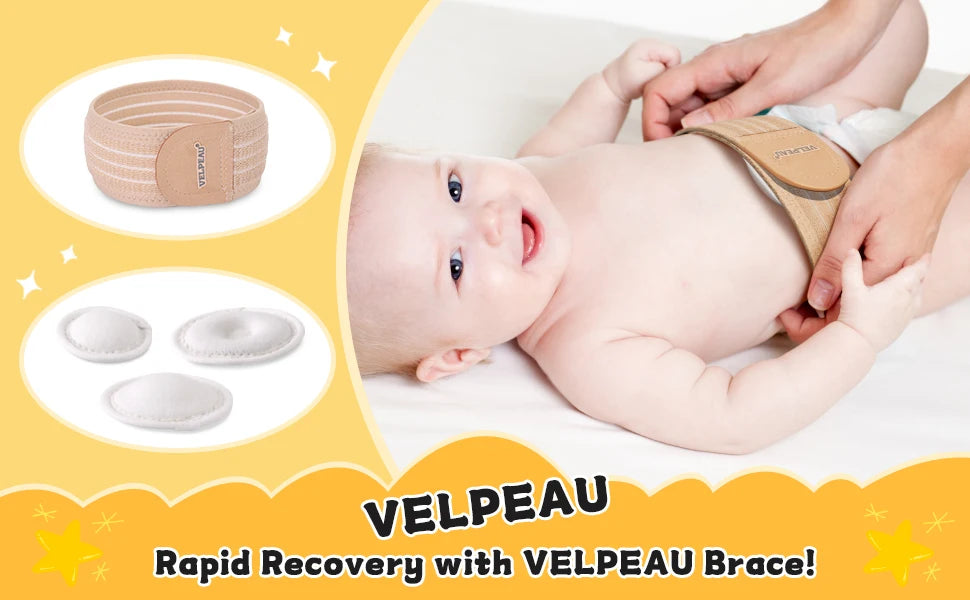 VELPEAU-Cinturón de Hernia Umbilical para bebé, envoltura de ombligo infantil, Truss, carpeta Abdominal con 3 almohadillas de compresión de diferentes formas